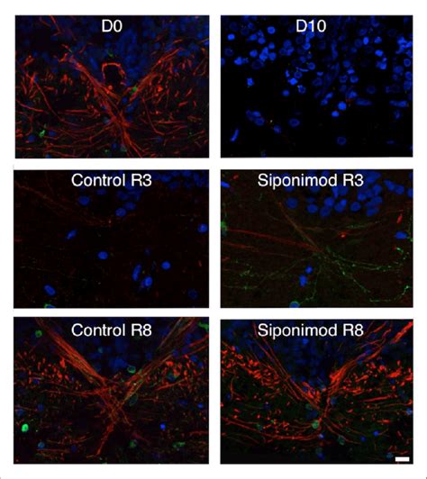 Loss Or Recovery Of Gfp Cells Corresponds To Demyelination Or