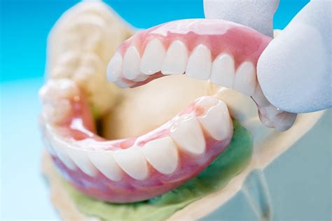 Puente Dental Tipos Beneficios Y Desventajas Mejor Con Salud