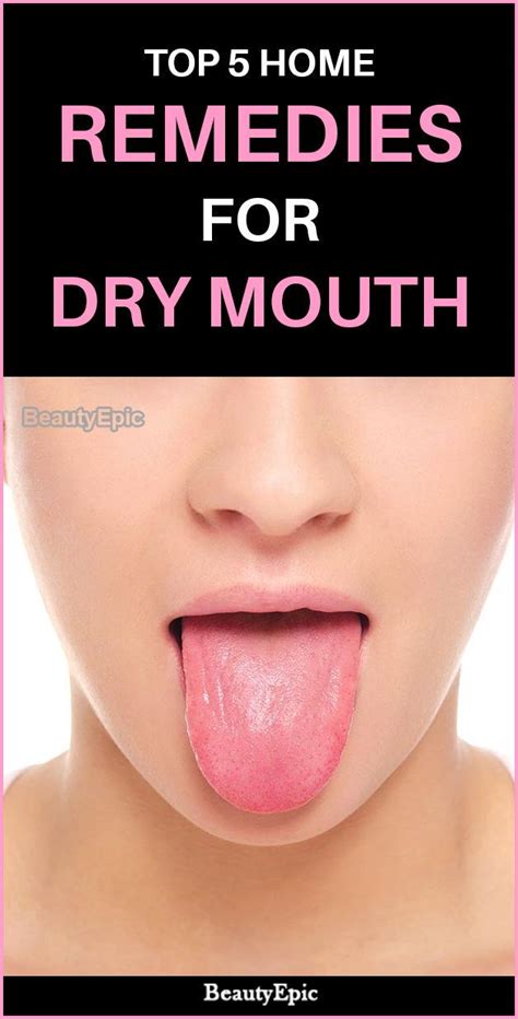 Top 5 Effective Home Remedies To Cure Dry Mouth Remedies For Dry