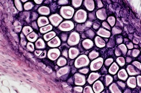 Elastic Cartilage Light Micrograph Stock Image C0184539 Science