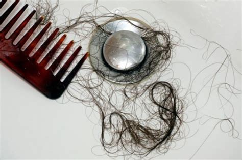6 Reasons Why Your Hair Is Shedding More Than Normal Women Daily Magazine