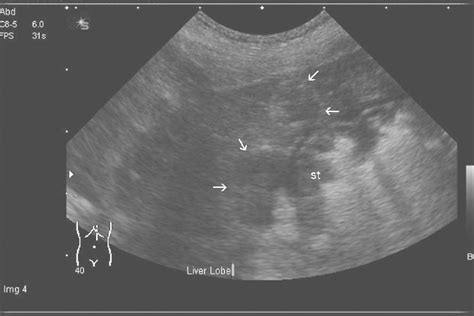 Sagittal Plane Ultrasonograph Of The Liver And Gastric Fundus St