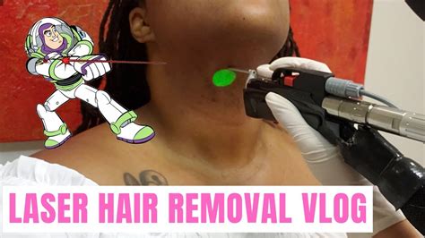 Laser Hair Removal Vlog Pt2 Come Get Zapped Zapped W Me Youtube