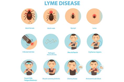 Treatment For Lyme Disease Philadelphia Holistic Clinic Dr Victor Tsan