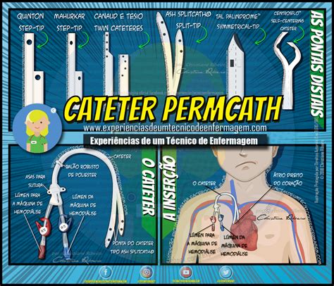 O Cateter Permcath O Que é Enfermagem Ilustrada