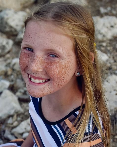 Pin By Paul Andersson On Fräknar Freckles Girl Freckles Gorgeous Girls