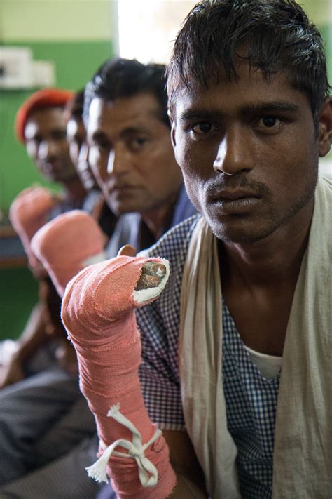 Ed Hanley: Documenting Leprosy in India