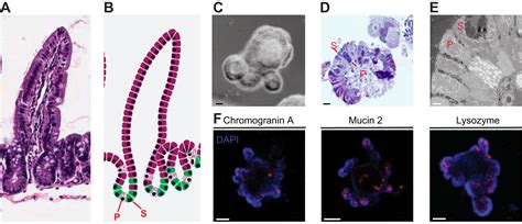 Gut Organoids Mini Tissues In Culture To Study Intestinal Physiology