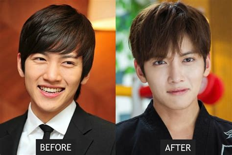 21 Korean Celebs Who Have Undergone Cosmetic Procedures Or Surgery