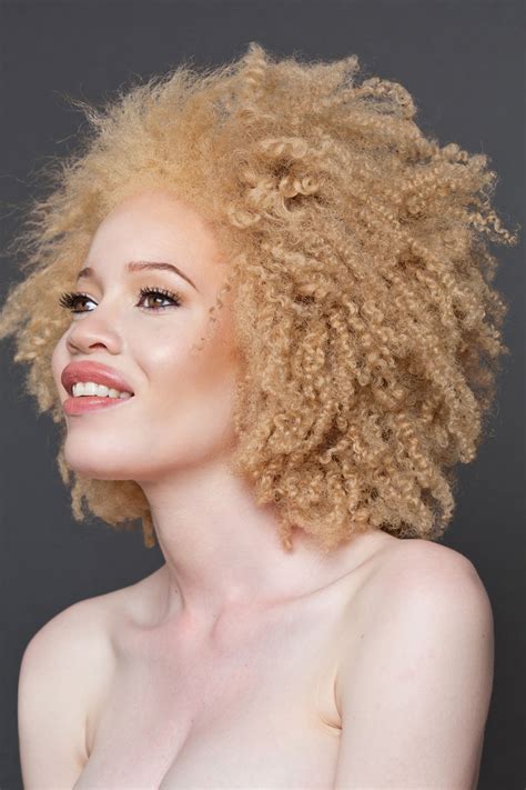 Beautiful Albino People