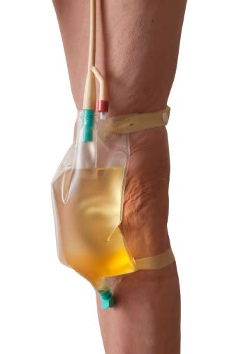 Check spelling or type a new query. Urinary Catheter In Use Stock Photo - Download Image Now ...