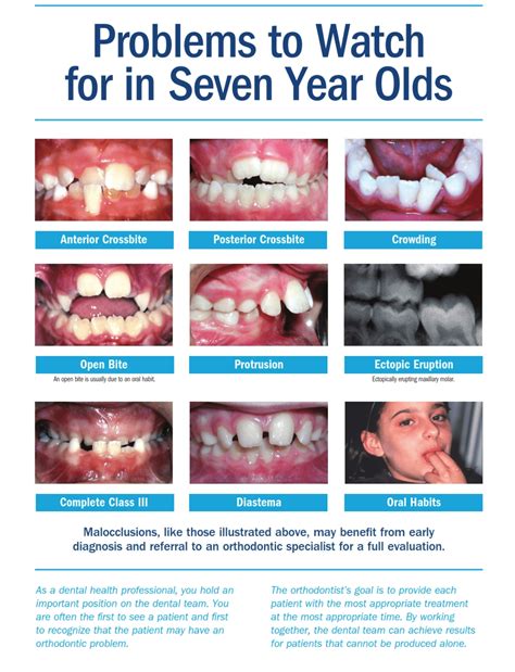 early orthodontic treatment concord ca lee orthodontics