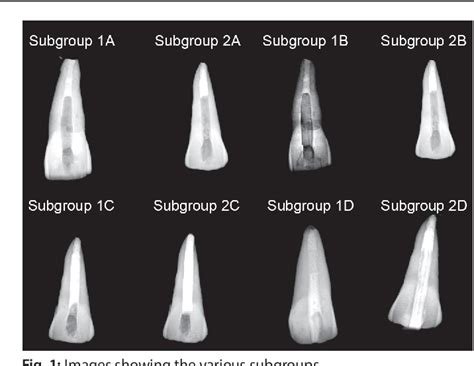 Figure From Comparative Evaluation Of The Fracture Resistance Of