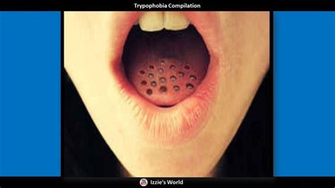 Pin On Trypophobia Images