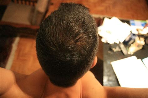 However, it appears that for treating hair loss, a daily dose of 2.5mg daily seems to generate the best results. image