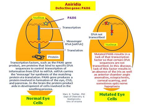 Aniridia 1 Hereditary Ocular Diseases