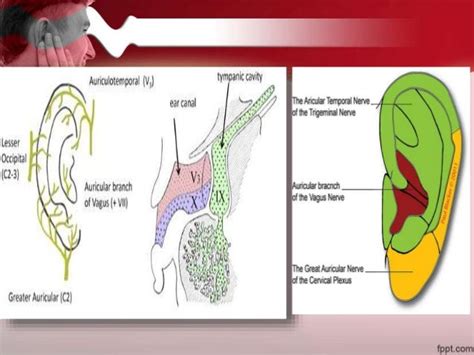 Otalgiaearache