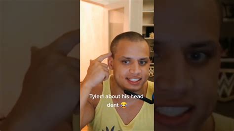 Tyler1 About His Head Dent 😱 Leagueoflegends Loltyler1 Tyler1 Youtube