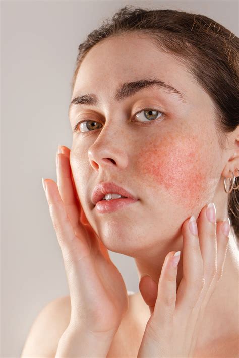 Magnesium Deficiency Skin Symptoms Five Spot Green Living
