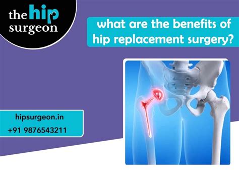 What Are The Benefits Of Hip Replacement Surgery The Hip Surgeon