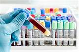 Blood Test Labs Without Doctor