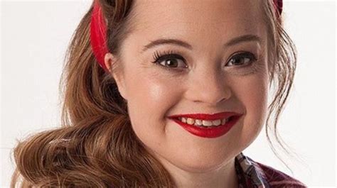 Katie Meade Is The First Model With Down Syndrome To Land A Beauty