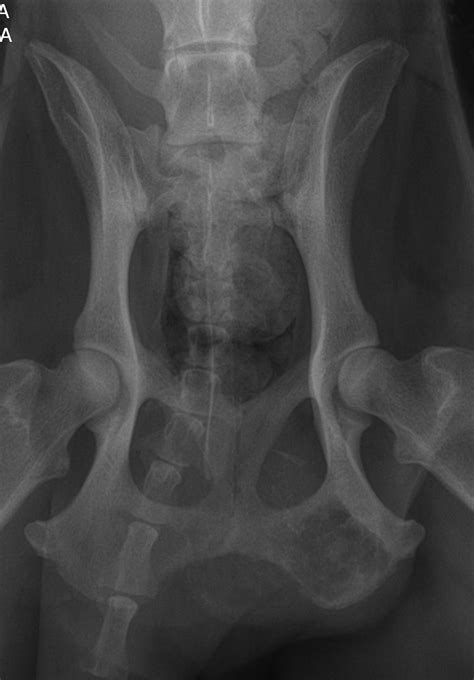 Bone Tumors Pelvic — Dr Julius Liptak