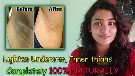 Underarm Whitening Treatment 100 Natural How To Lighten Dark