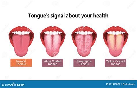 Tongues Health Sign Vector Illustration Wavy Tongue 211919894