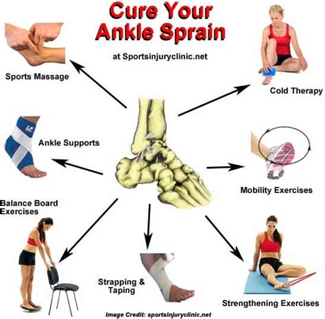 Take A Closer Look At Ankle Sprain Causes And Treatments Ankle Sprain Symptoms Ankle Sprain
