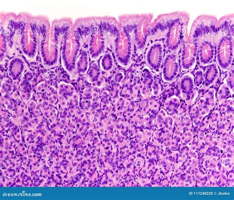 Gastric Mucosa Royalty Free Stock Image 117240298