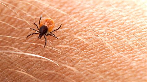 This Summer Protect Yourself From Tick Bites And Lyme Disease