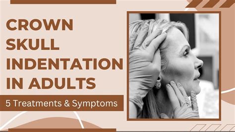 Crown Skull Indentation In Adults 6 Causes 5 Treatments And Symptoms