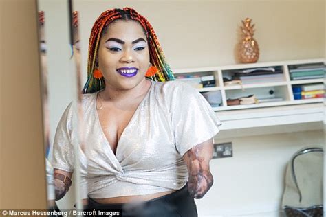 Quadruple Amputee Reveals How Beauty Helped Boost Her Confidence