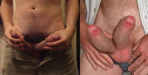 Man With Two Penises 22 Pics Xhamster