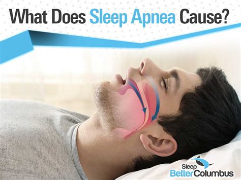 What Does Sleep Apnea Cause Secondary Conditions Caused By Osa