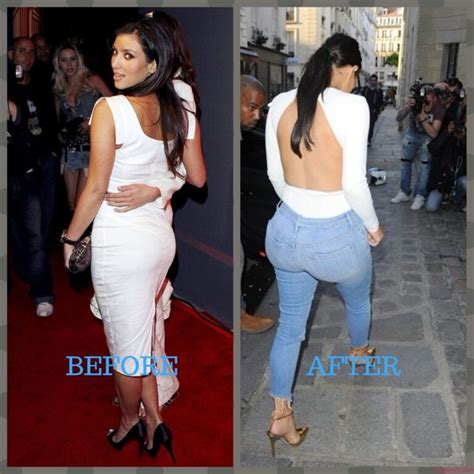 kim kardashian plastic surgery photos [before and after] surgery4