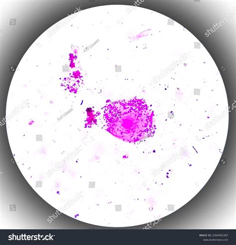 Smear Human Body Fluid Grams Stained Stock Photo 2264491287 Shutterstock