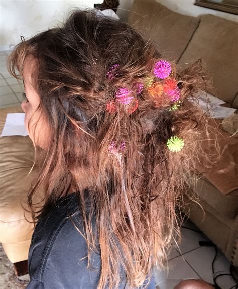 My Daughters Hair After She Thought It Would Be Funny To Put Bunchems