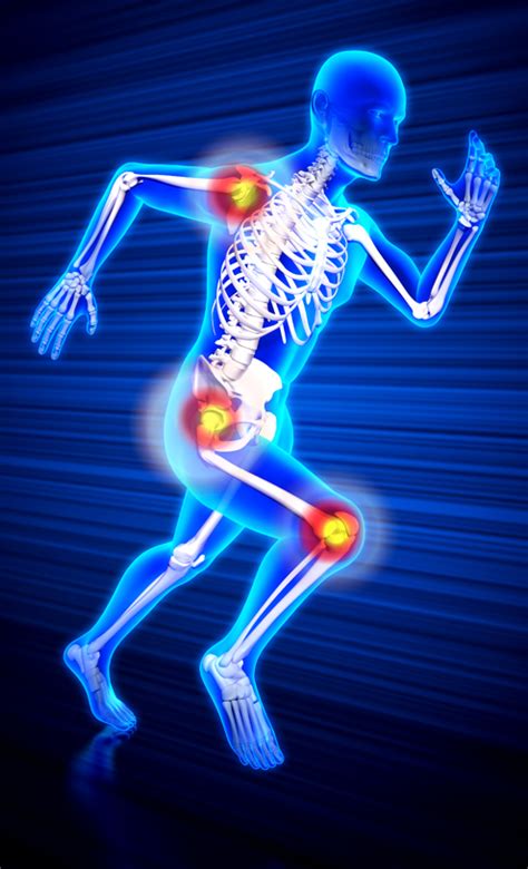 Assess Your Joint Pain Lifespan Orthopedic Institute