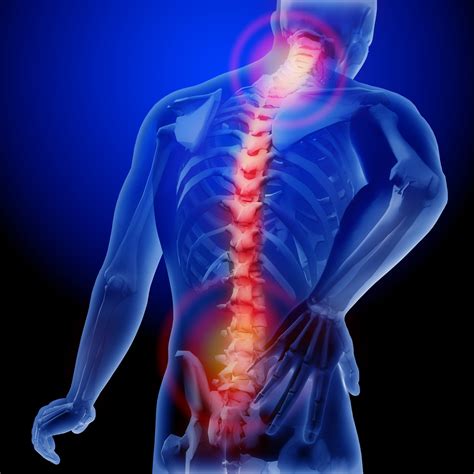 Neurological Pain Syndrome Southeast Pain And Spine Care