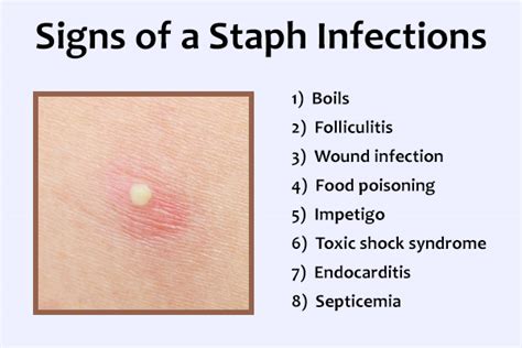 How To Cure A Staph Infection Amountaffect17
