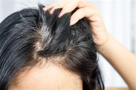 Is Your Hair Turning Grey Fight It With Thrivecos Hair Prime Serum