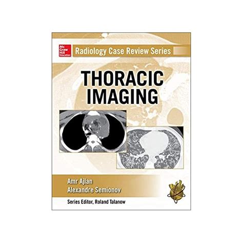 Radiology Case Review Series Thoracic Imaging