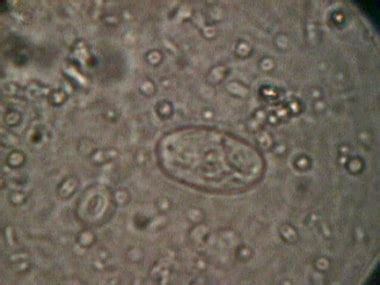 Sample Giardia Under Microscope Micropedia
