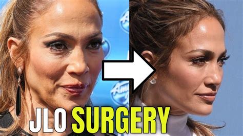 Jennifer Lopez Plastic Surgery 2020 Usa Gossip Celebrities