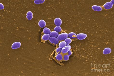 Enterococcus Faecalis Bacteria Sem Photograph By Science Source