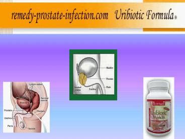 PPT Prostate Infection PowerPoint Presentation Free To Download Id Cca Y VkY