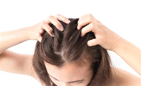 10 Symptoms Of Head Lice Facty Health