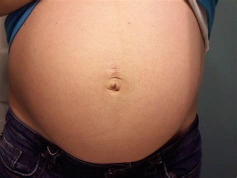 UGLY Belly Buttons BabyCenter